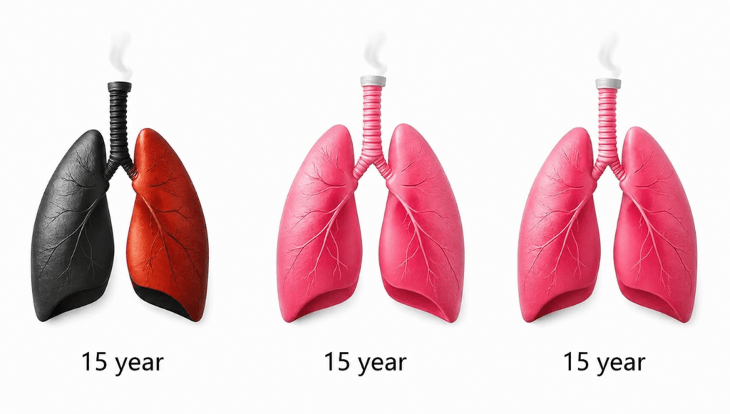 Risk of Lung Cancer after Quitting Smoking: Health After 15 Years