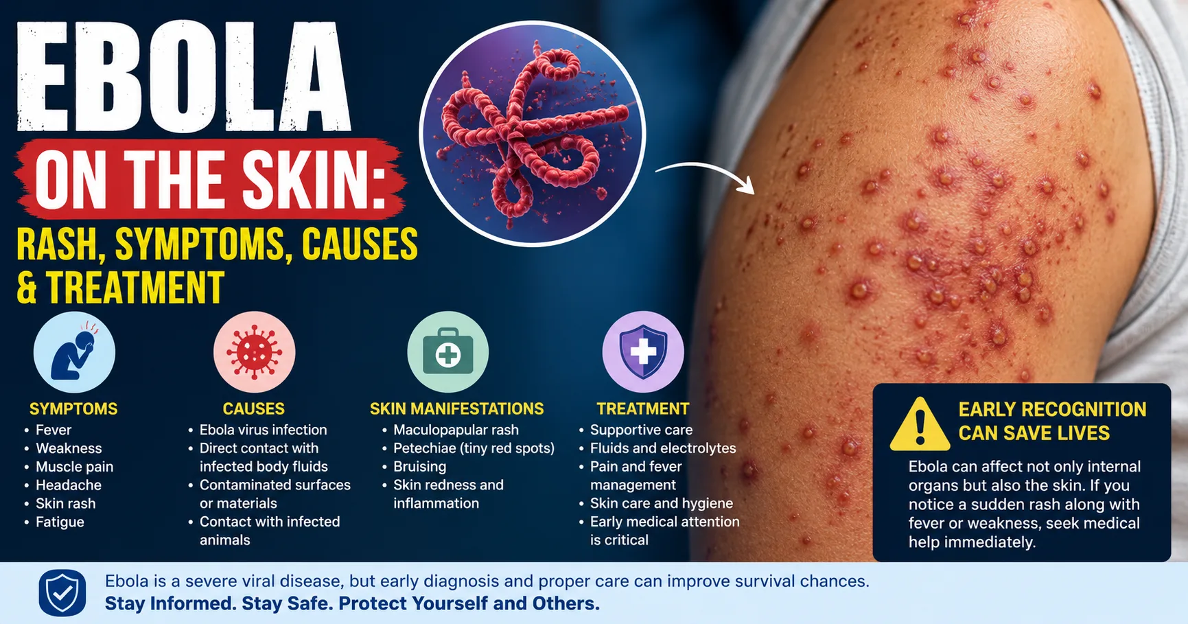 Ebola rash symptoms