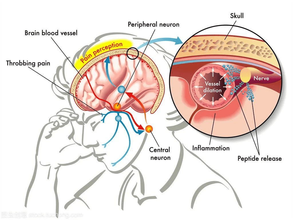 How Long Do Migraines Last