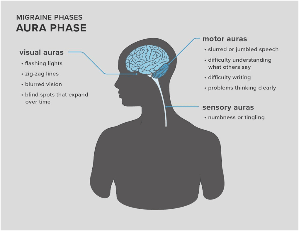 Aura Phase: Visual and Sensory Changes