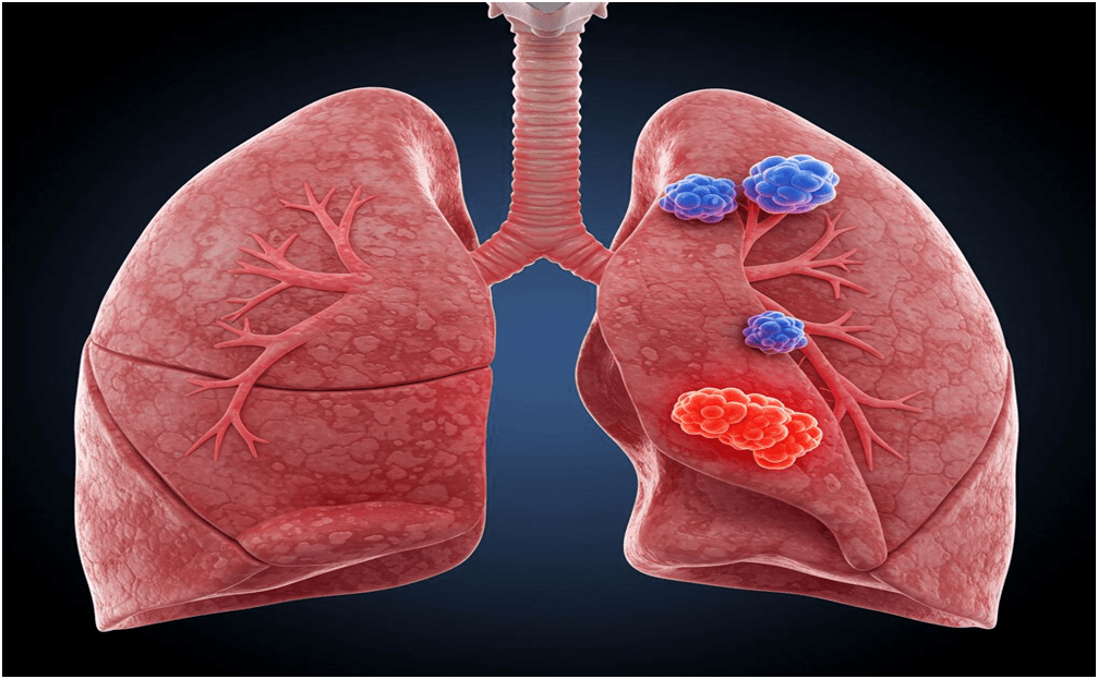 Lungs