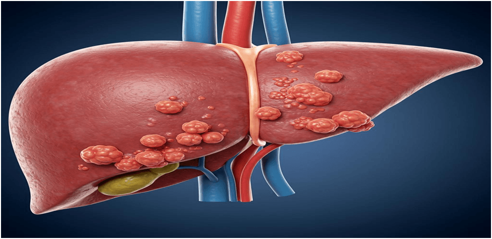 Liver