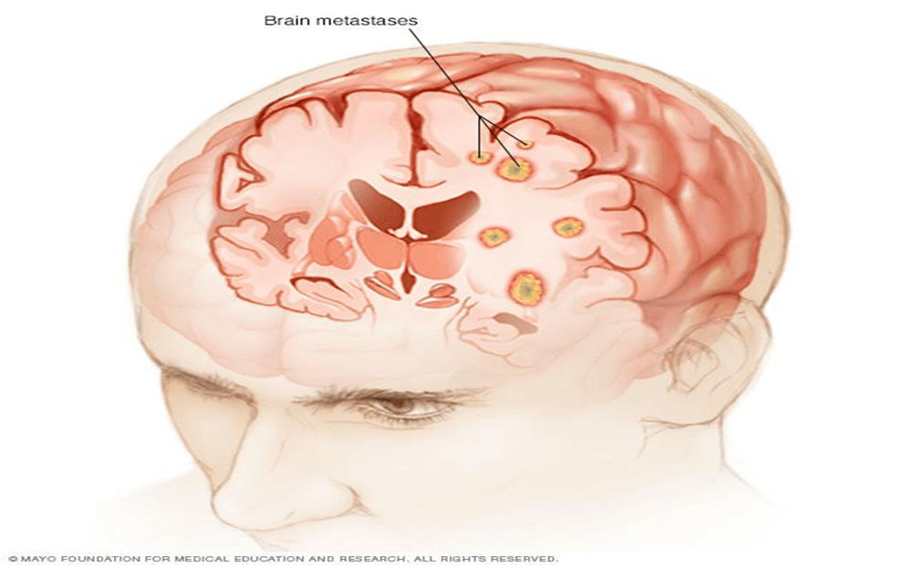 Brain